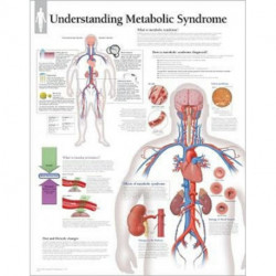 Understanding Metabolic Syndrome Laminated Poster