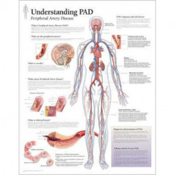 Understanding PAD Paper Poster