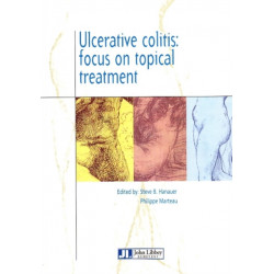 Ulcerative Colitis: Focus on Topical Treatmen