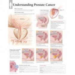Understanding Prostate Cancer Paper Poster