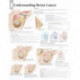 Understanding Breast Cancer Paper Poster