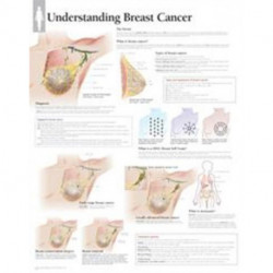Understanding Breast Cancer Paper Poster