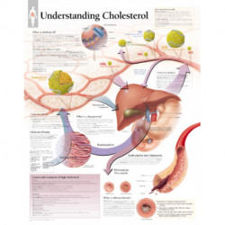 Understanding Cholesterol Paper Poster