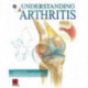 Understanding Arthritis Flip Chart