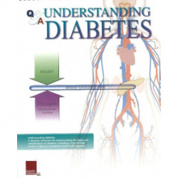 Understanding Diabetes Flip Chart