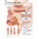 Understanding IBS Paper Poster