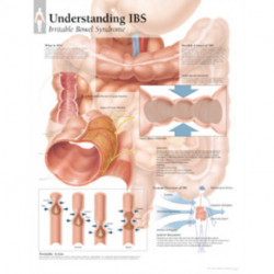 Understanding IBS Paper Poster