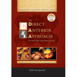 The Direct Anterior Approach to Hip Reconstruction
