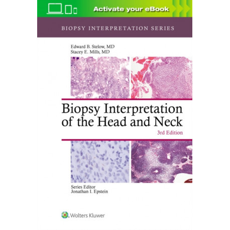 Biopsy Interpretation of the Head and Neck