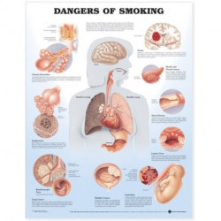 Dangers of Smoking Anatomical Chart