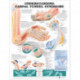 Understanding Carpal Tunnel Syndrome Anatomical Chart