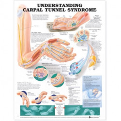 Understanding Carpal Tunnel Syndrome Anatomical Chart