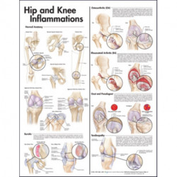 Hip and Knee Inflammations Anatomical Chart