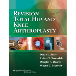 Revision Total Hip and Knee Arthroplasty