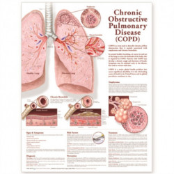 Chronic Obstructive Pulmonary Disease Anatomical Chart