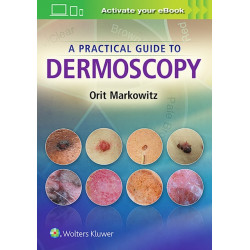 A Practical Guide to Dermoscopy