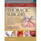 Master Techniques in Surgery: Thoracic Surgery: Transplantation, Tracheal Resections, Mediastinal Tumors, Extended Thoracic Resections