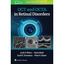 OCT and OCTA in Retinal Disorders