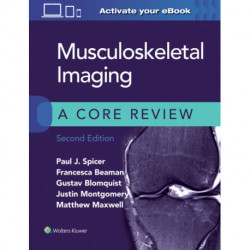 Musculoskeletal Imaging: A Core Review