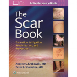 The Scar Book: Formation, Mitigation, Rehabilitation and Prevention