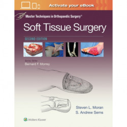 Master Techniques in Orthopaedic Surgery: Soft Tissue Surgery