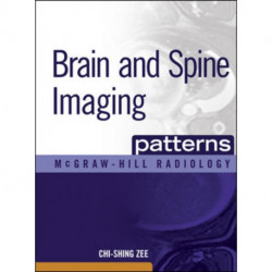 Brain and Spine Imaging Patterns