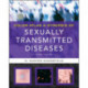 Color Atlas & Synopsis of Sexually Transmitted Diseases, Third Edition