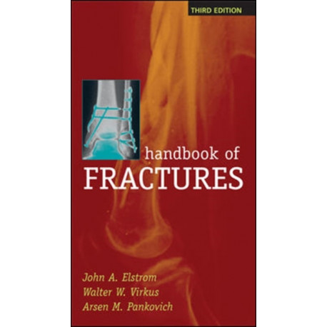 Handbook of Fractures, Third Edition