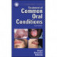 Treatment Common Oral Conditions