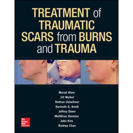 Treatment of Scars from Burns and Trauma