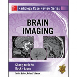 Radiology Case Review Series: Brain Imaging