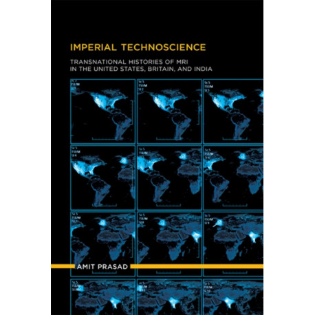 Imperial Technoscience: Transnational Histories of MRI in the United States, Britain, and India
