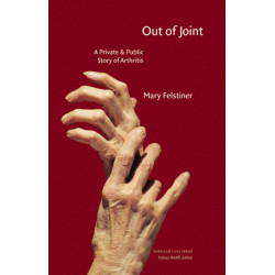 Out of Joint: A Private and Public Story of Arthritis