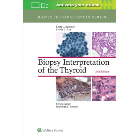 Biopsy Interpretation of the Thyroid