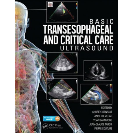 Basic Transesophageal and Critical Care Ultrasound