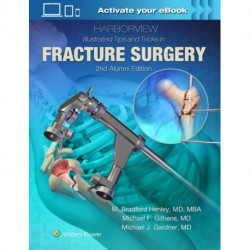 Harborview Illustrated Tips and Tricks in Fracture Surgery