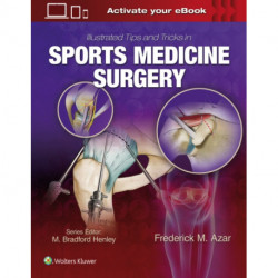 Illustrated Tips and Tricks in Sports Medicine Surgery