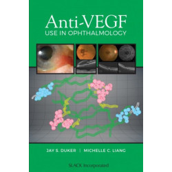 Anti-VEGF Use in Ophthalmology