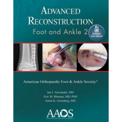 Advanced Reconstruction: Foot and Ankle 2: Print + Ebook