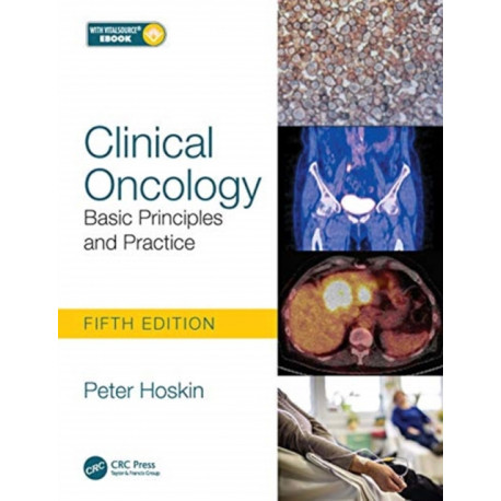 Clinical Oncology: Basic Principles and Practice