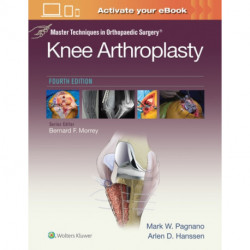 Master Techniques in Orthopedic Surgery: Knee Arthroplasty