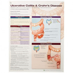 Ulcerative Colitis & Crohn's Disease