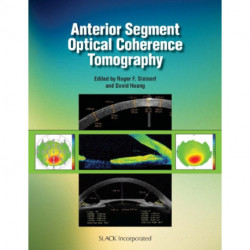 Anterior Segment Optical Coherence Tomography