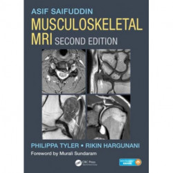 Musculoskeletal MRI