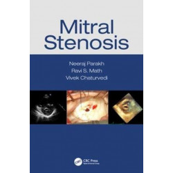 Mitral Stenosis