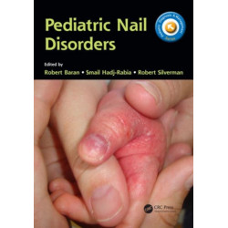 Pediatric Nail Disorders