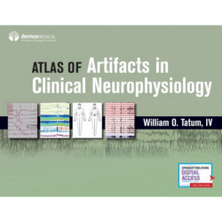Atlas of Artifacts in Clinical Neurophysiology