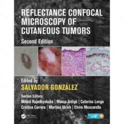 Reflectance Confocal Microscopy of Cutaneous Tumors