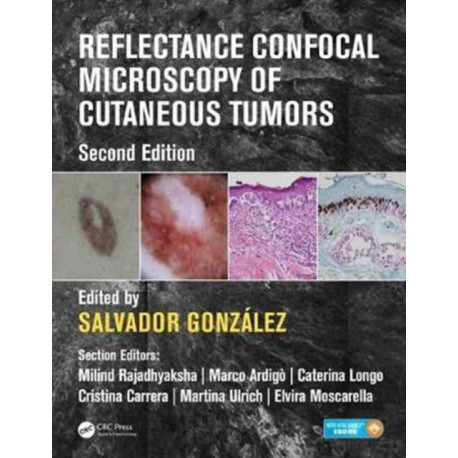 Reflectance Confocal Microscopy of Cutaneous Tumors