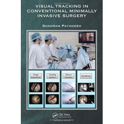 Visual Tracking in Conventional Minimally Invasive Surgery